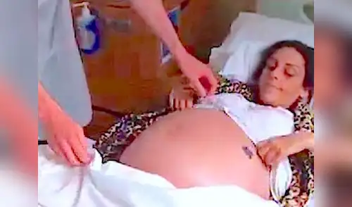 La mujer debe someterse a un fuerte tratamiento elpopular.pe