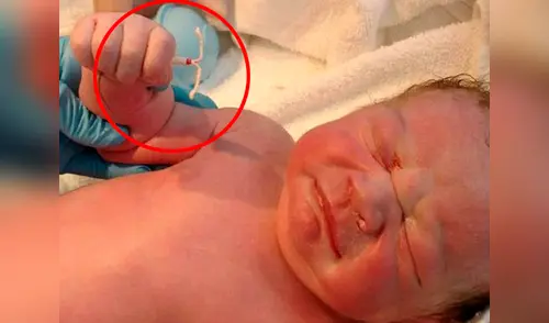 El bebé se negó a la ciencia y vivió para hacer historia elpopular.pe