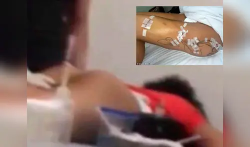 Las mujeres no escatiman por lograr el cuerpo perfecto elpopular.pe