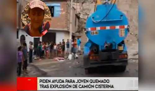 Madre pide ayuda para joven quemado tras explosión de camión cisterna en Huaycán elpopular.pe