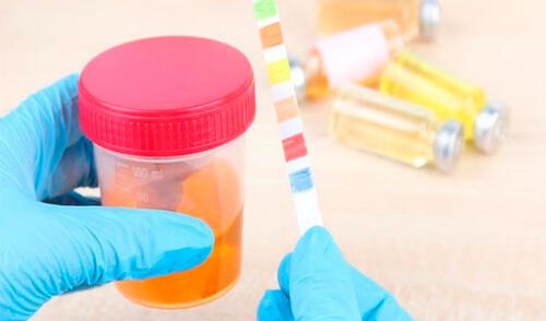 Cuando es amarillo pálido o transparente, es señal de que gozas de muy buena salud elpopular.pe