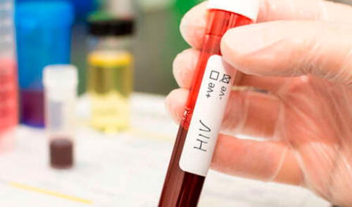 Dos menores de edad fueron diagnosticados con VIH en Piura elpopular.pe