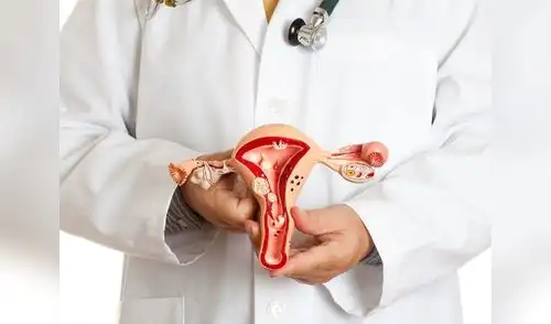 El 92% de los cánceres uterinos ocurren en el endometrio elpopular.pe
