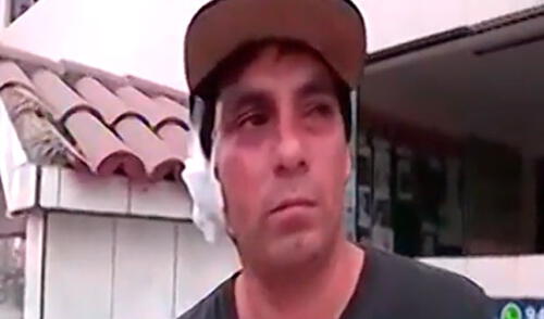 Mesero fue agredido por su compañero de trabajo elpopular.pe