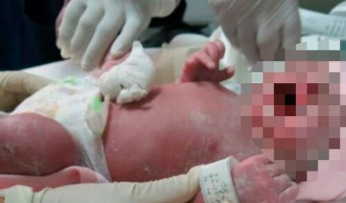 A bebé le cortaron el cuello y el tórax en Argentina elpopular.pe