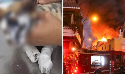 Rescatan a gata que sufrió quemaduras en incendio de Mesa Redonda elpopular.pe