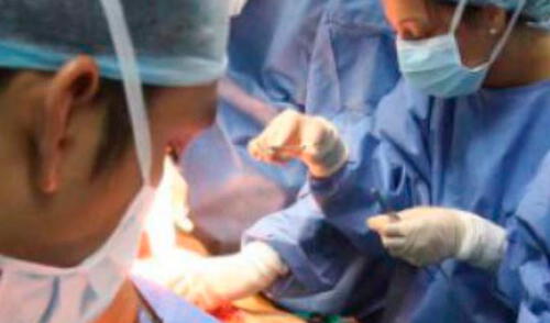 Donación de órganos salva vidas elpopular.pe