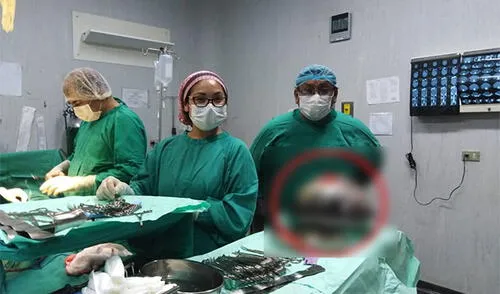 Médicos del Hospital de Ventanilla salvaron a mujer elpopular.pe