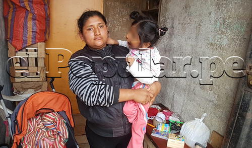 Madre de El Agustino pide ayuda para su hija con microcefalia elpopular.pe