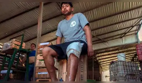 La víctima recibió un disparo en la pierna elpopular.pe