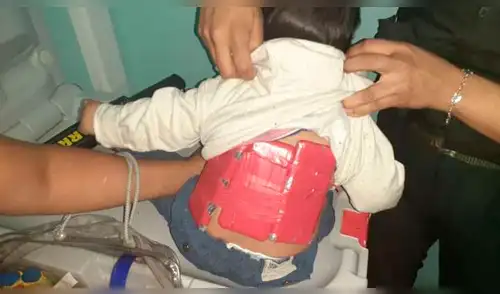 El niño tenía tres celulares forrados con cinta adhesiva en su cuerpo elpopular.pe