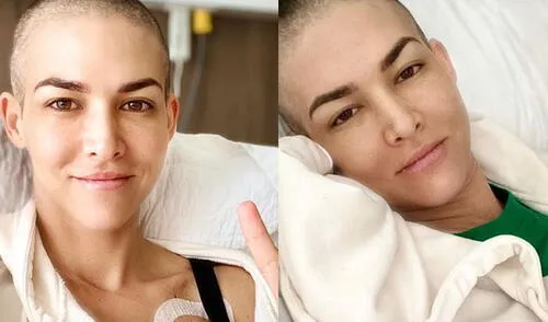 Manifestó su preocupación por las personas que también padecen esta enfermedad elpopular.pe