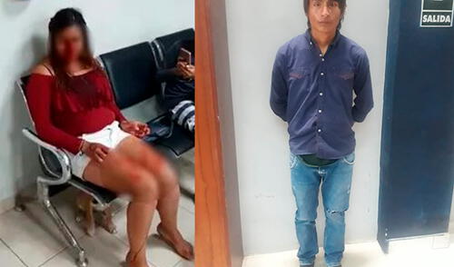 Sujeto le reventó botella en la cara a conviviente y golpeó salvajemente a su hijo elpopular.pe