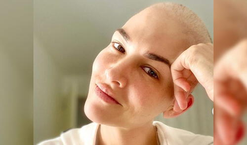 No deja de ver la vida con optimismo elpopular.pe