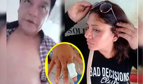 Sujeto mascar a golpes a ex pareja y le corta el dedo elpopular.pe