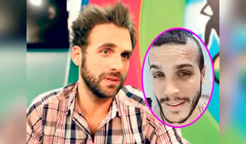 Como se recuerda, hace unas dos semanas, Mario Irivarren sorprendió al someterse a un implante de cabello. elpopular.pe