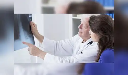 Consultamos con un experto para desterrar las ideas falsas en torno al cáncer elpopular.pe