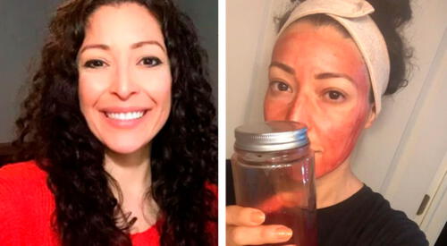 Mujer que utiliza su menstruación como mascarilla asegura que le deja la “piel brillante” elpopular.pe