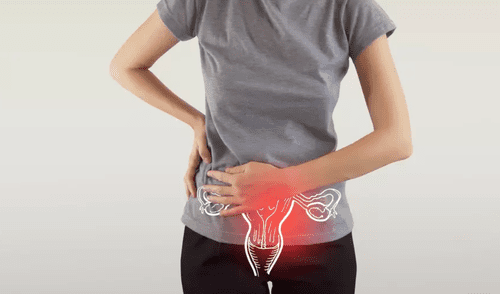 Acude a tus chequeos ginecológicos periódicamente. elpopular.pe