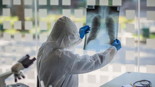 Hipoxia, síntoma silencioso de la COVID-19. elpopular.pe