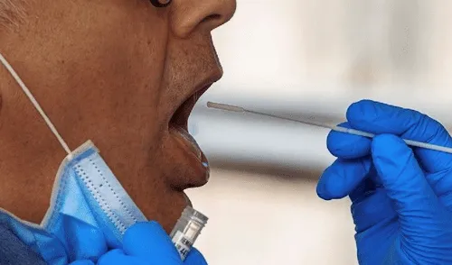 Las pruebas serológicas son las más efectivas. elpopular.pe