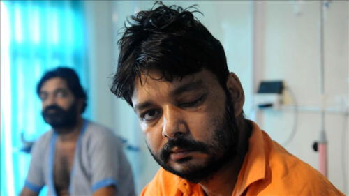 En el hongo negro afecta a quienes tienen el sistema inmune débil. elpopular.pe