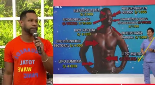 El doctor Fong llegó a América Hoy para evidenciar los procedimientos a los que se sometió Edson Dávila, pero aseguró que él se mantiene con ejercicios. elpopular.pe