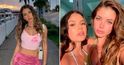 La actriz se habría realizado nueva intervención estética en el rostro. elpopular.pe