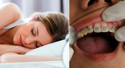 Significado de soñar con los brackets. elpopular.pe