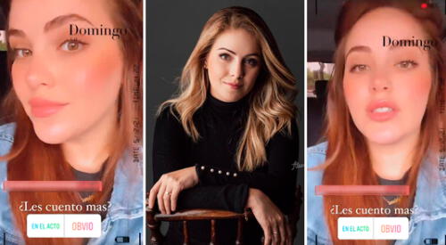 Mariana Vértiz decidió hacerse un retoquito en el rostro. elpopular.pe