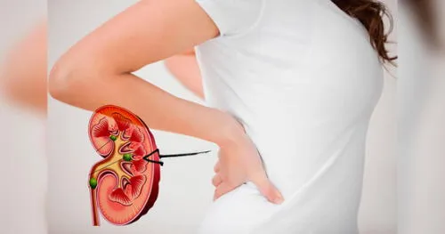 Descubre cómo cuidar tus riñones con estos consejos fáciles de seguir en tu rutina diaria. elpopular.pe