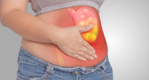 El cáncer de estómago, también conocido como cáncer gástrico, puede atacar cualquier parte del estómago. elpopular.pe