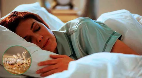 Conoce aquí los diferentes significados de soñar con piojos y liendres. elpopular.pe