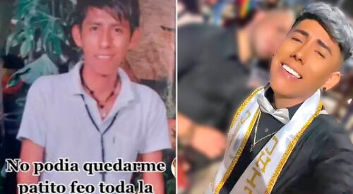 El joven se sometió a cirugías plásticas para parecerse al novio de Barbie. elpopular.pe