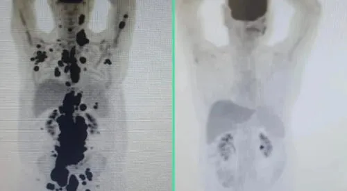 Paulo Peregrino es víctima del cáncer desde el 2018. elpopular.pe