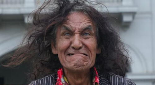 Mondonguito la pasa mal y pide ayuda para pagar su operación. elpopular.pe