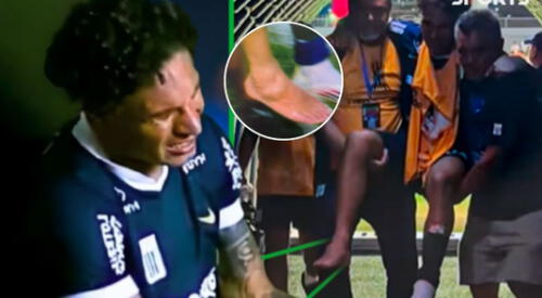 Paolo Guerrero sufre esguince de tobillo y lesión lo deja fuera del partido con Nacional. elpopular.pe