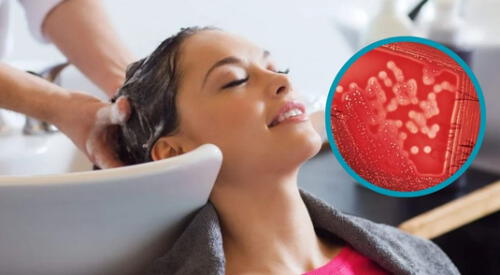 La Agencia Española de Medicamentos y Productos Sanitarios (Aemps) anunció el retiro masivo de un lote del shampoo Color Vivo de la marca Biopoint Milano. elpopular.pe