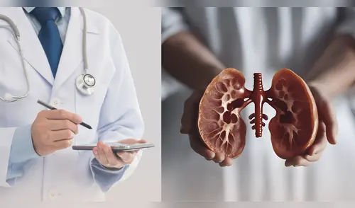 Es necesario tomar medidas preventivas y hacerse chequeos periódicos para garantizar la salud renal. elpopular.pe