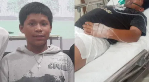 Niño de 12 años con infección generalizada necesita ayuda. elpopular.pe
