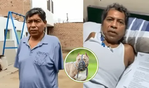 Pitbulls destrozan la vida de un peruano: sin brazos, en coma y sin respuesta legal. elpopular.pe