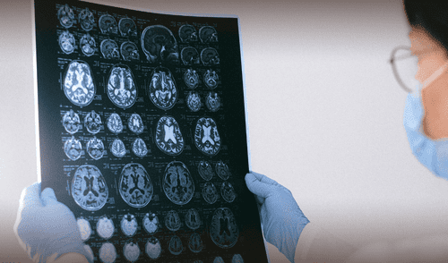 Científicos identifican patrones cerebrales únicos en personas con rasgos psicopatas. elpopular.pe