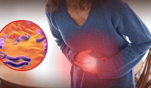 Esta es la bacteria peligrosa asociada al cáncer de estómago, según científicos. elpopular.pe