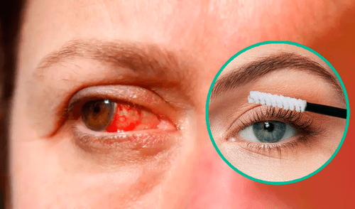 ANMAT ordenó el retiro de productos de belleza y limpieza de uso cotidiano por peligrosos riesgos sanitarios elpopular.pe