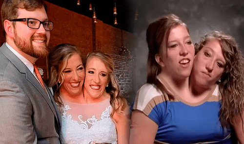 Abby y Brittany Hensel fueron fotografiadas con un bebé y generaron enigmáticas dudas sobre su vida privada elpopular.pe