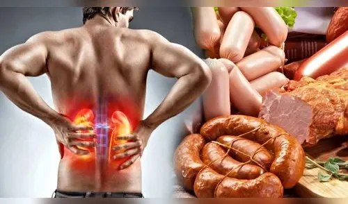 Los nefrólogos advierten sobre estos alimentos que pueden dañar tu salud renal a largo plazo. elpopular.pe