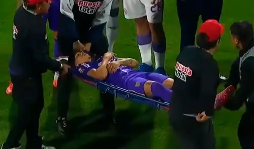 Kevin Quevedo sufrió un golpe en la cabeza en los primeros segundos del partido. Foto: captura/L1 Max elpopular.pe