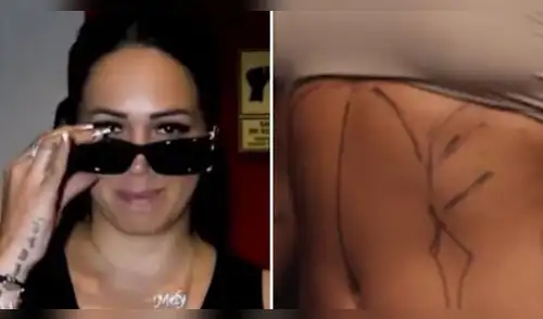 Melissa Klug CONFIESA los verdaderos motivos de sus recientes cirugías estéticas tras romper con Jesús Barco elpopular.pe