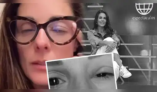 Rebeca Escribens preocupa al aparecer con un ojo CERRADO y PARALIZADO: Revela la complicada enfermedad que la ALEJA de América Espectáculos elpopular.pe