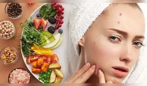 Aprende cómo la nutrición influye en tu piel y qué alimentos debes priorizar. elpopular.pe